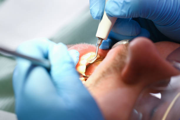 Best Knocked-Out Tooth Emergency  in Mowbray Mountain, TN