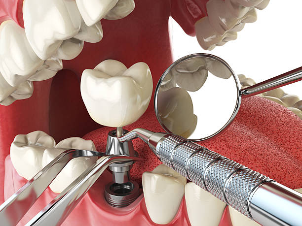 Dentist for Dental Trauma in TN